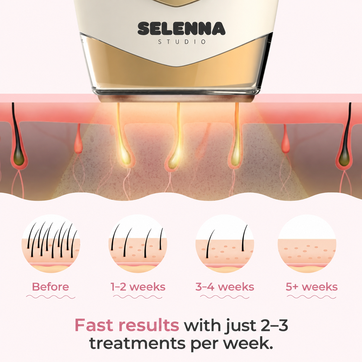 SELENNA IPL PRO™