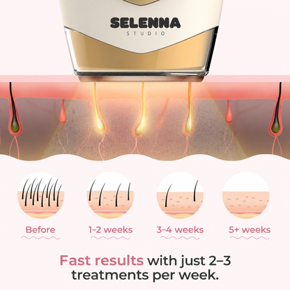 SELENNA IPL PRO™