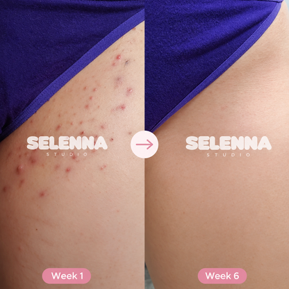 SELENNA IPL PRO™